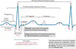 Generate an articial ECG signal in Python